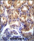 TRPM6 (CHAK2) Antibody (Center)